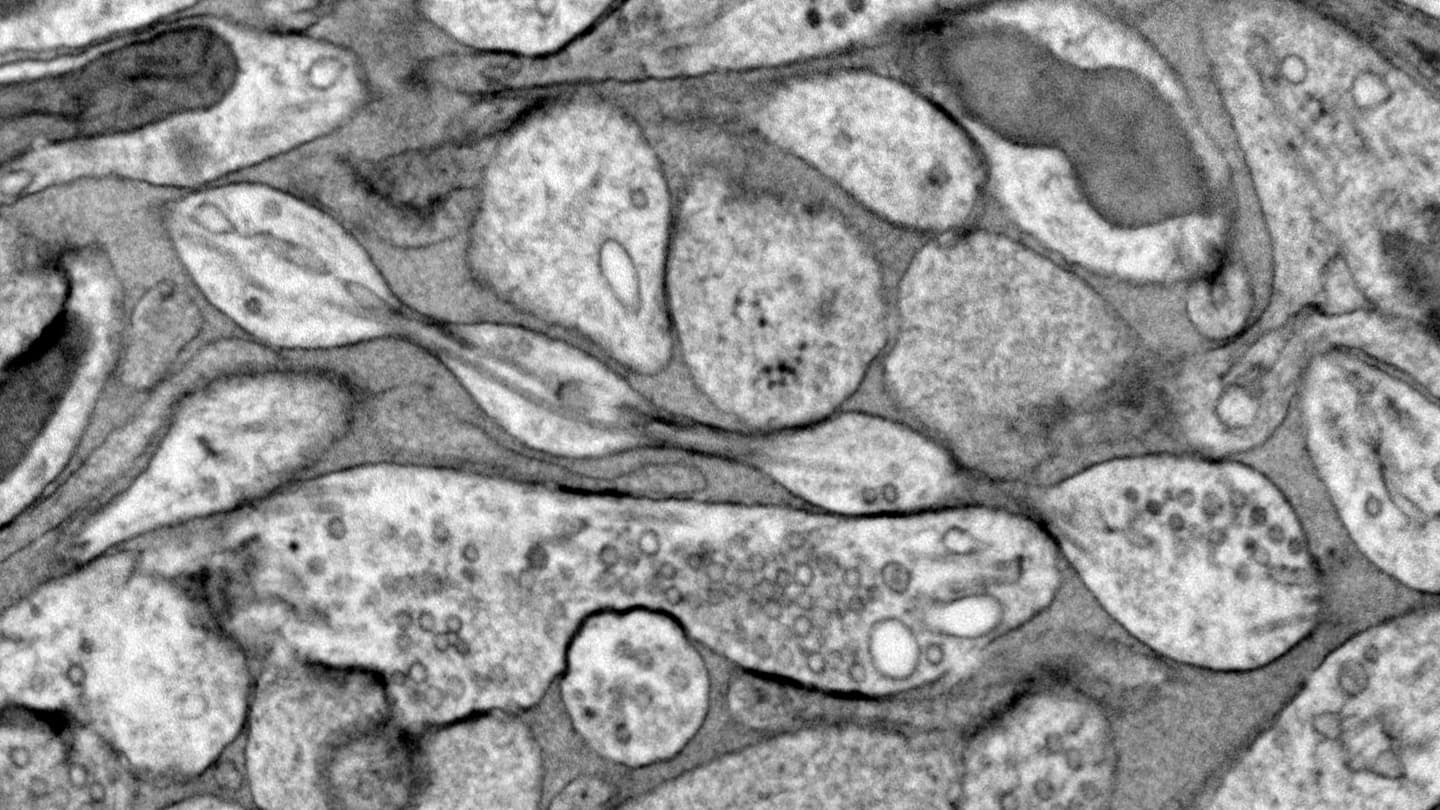 The message-sending part of neurons may be blobby, not smooth