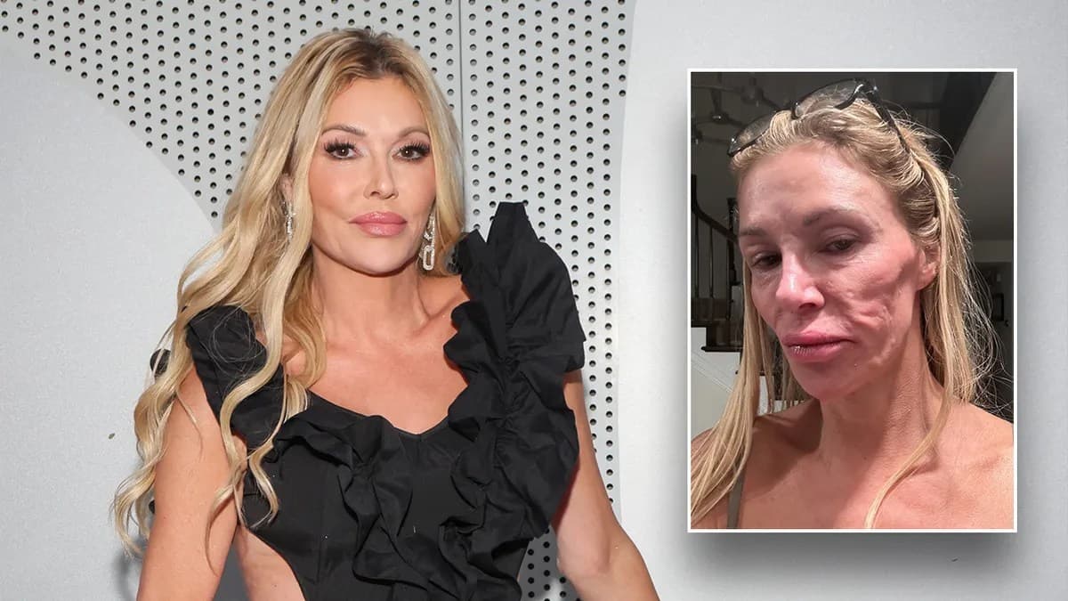 Brandi Glanville spending ‘all of my money’ looking for answers to mystery illness that left her disfigured