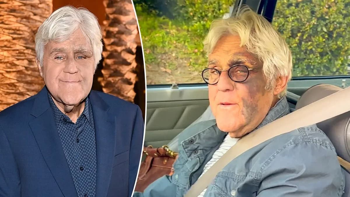 Jay Leno addresses rumors his facial injuries were related to mob retaliation