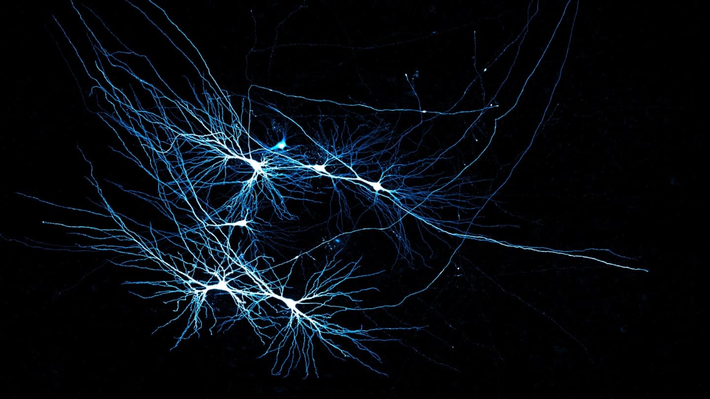 The unique neural wiring of the human hippocampus may maximize memory