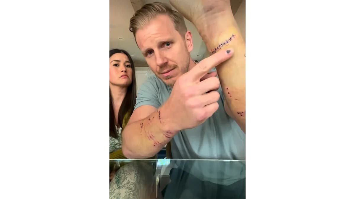 ‘Bachelor’ alum Sean Lowe suffers severe injuries after his dog attacked him twice in 12 hours