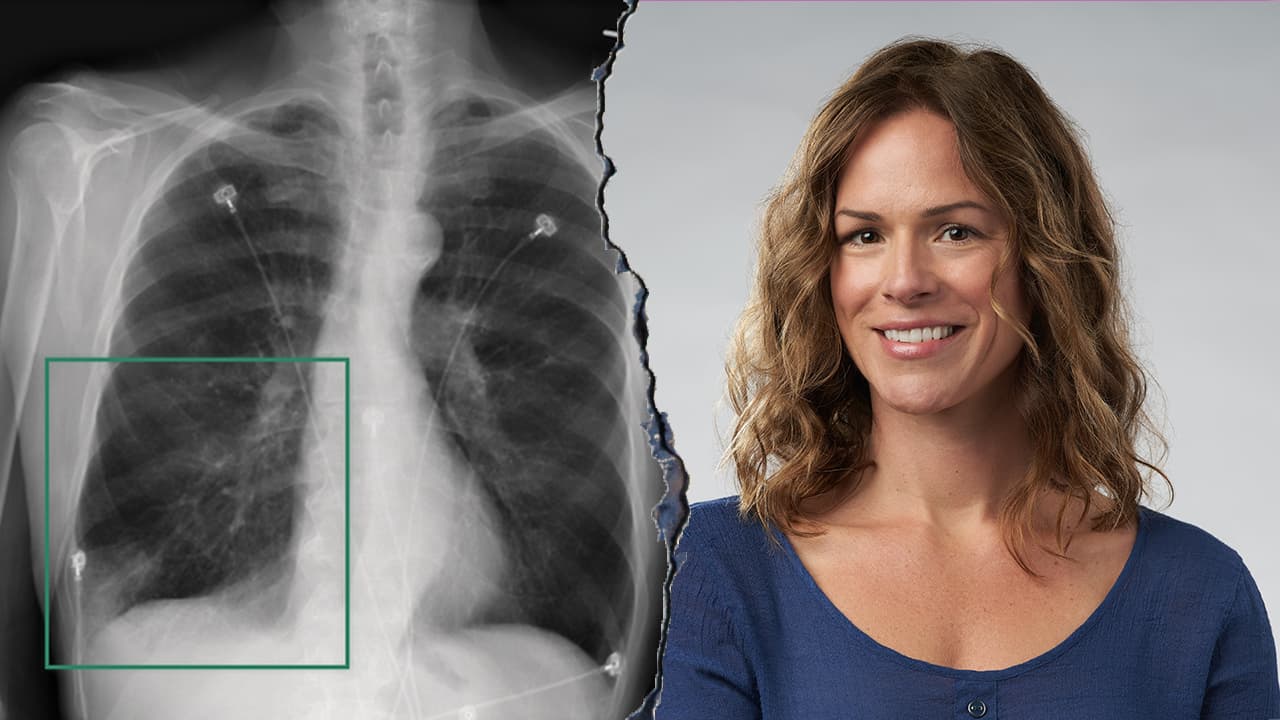 Nvidia revolutionizes hospitals with AI robots and voice assistants to address worker shortage